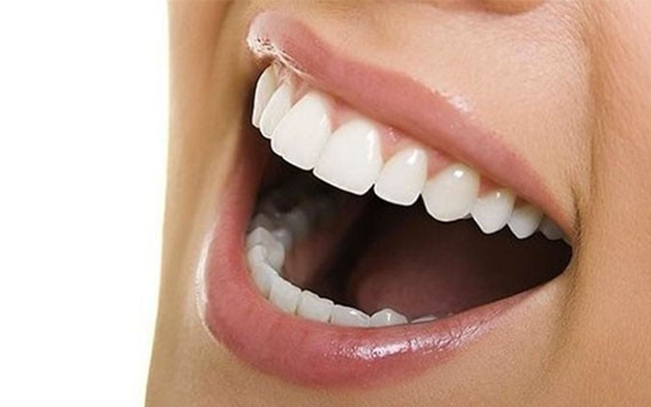 Ortodontik diş tedavisinde yeni yöntem: Telsiz ortodonti