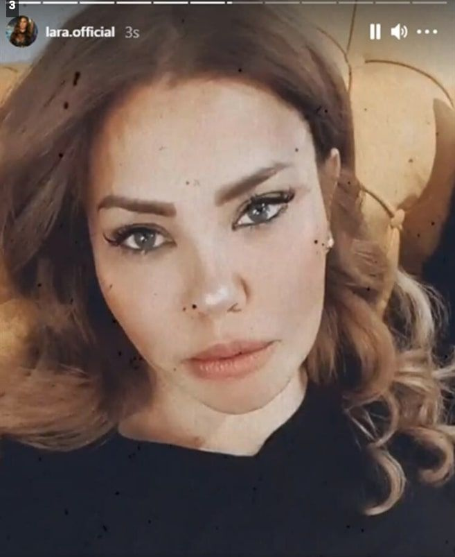 Şarkıcı Lara estetikle dudaklarını küçültmüştü eleştirilere isyanı bastı