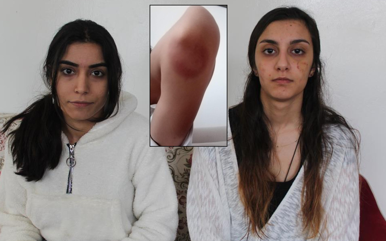Gaziantep'te cenaze dehşet! Halası yüzünü ısırdı kaşları yırtıldı: Özel bölgelerimi açamadım