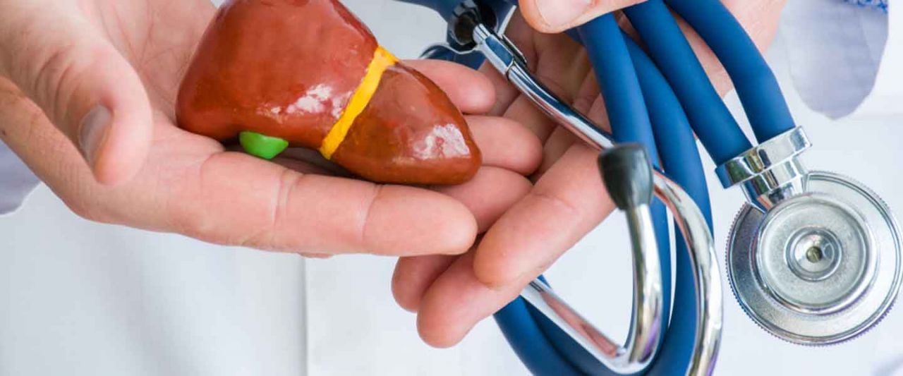 Karaciğer yağlanması belirtileri karaciğer yağlanması nasıl geçer?