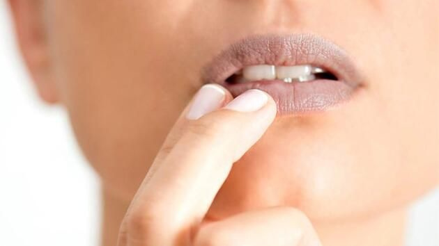 Ağız kuruluğu neden olur ağız kuruluğu nasıl geçer?