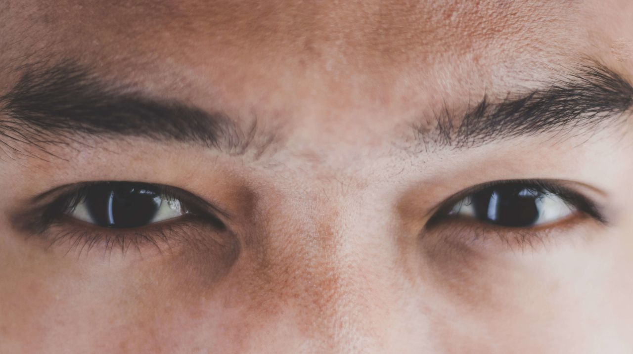 Göz seğirmesi neden olur göz seğirmesi nasıl tedavi edilir?