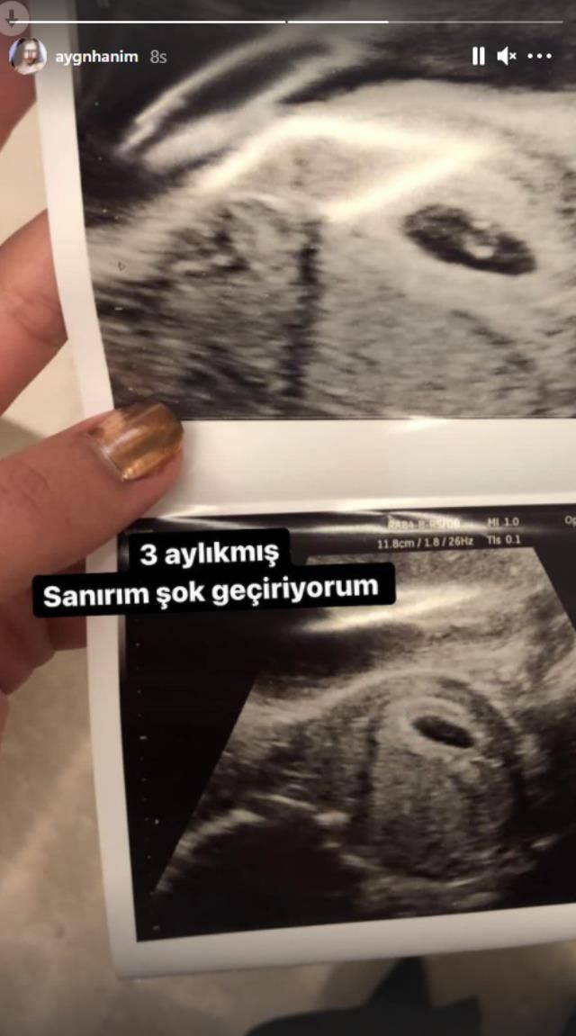 Aygün Aydın ultrason görüntüsü paylaştı bebek 3 aylık Hakan Sabancı'ya küfürler savurmuştu