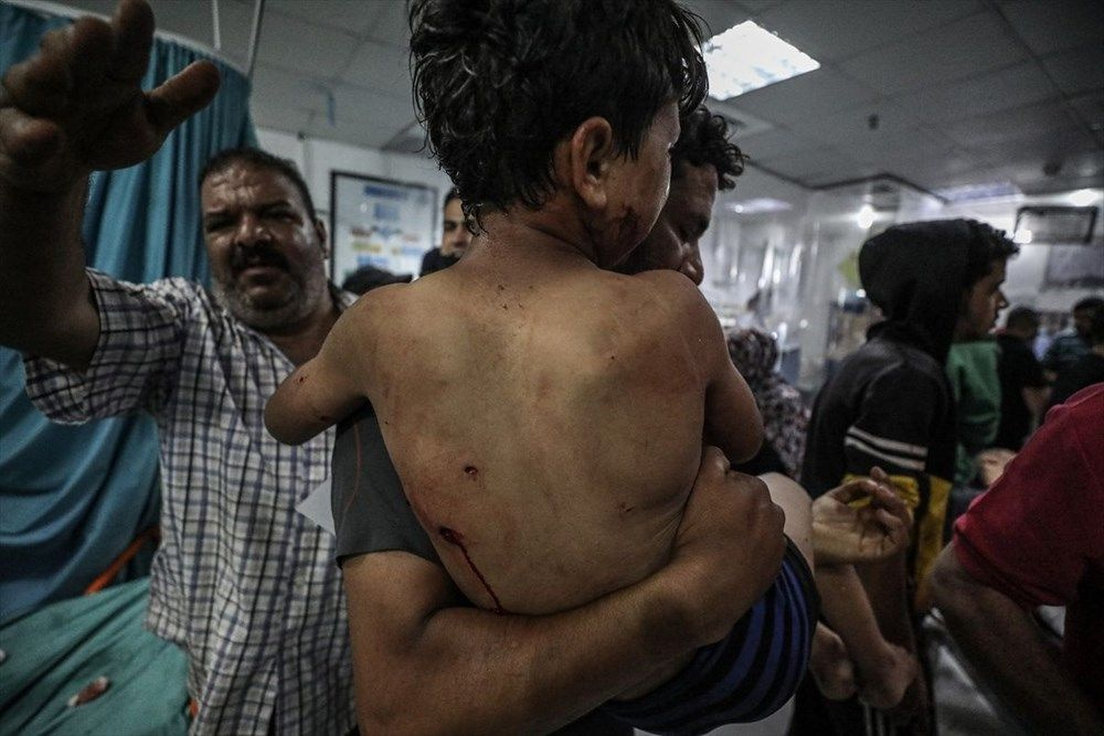 İsrail'in Gazze'ye saldırıları sürüyor: Can kaybı 50'yi geçti 320 kişi yaralandı