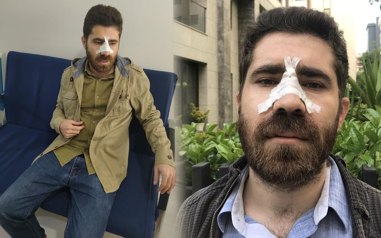 İstanbul'da sokakta pusu kurup dehşeti yaşattılar! Sebebi şok etti