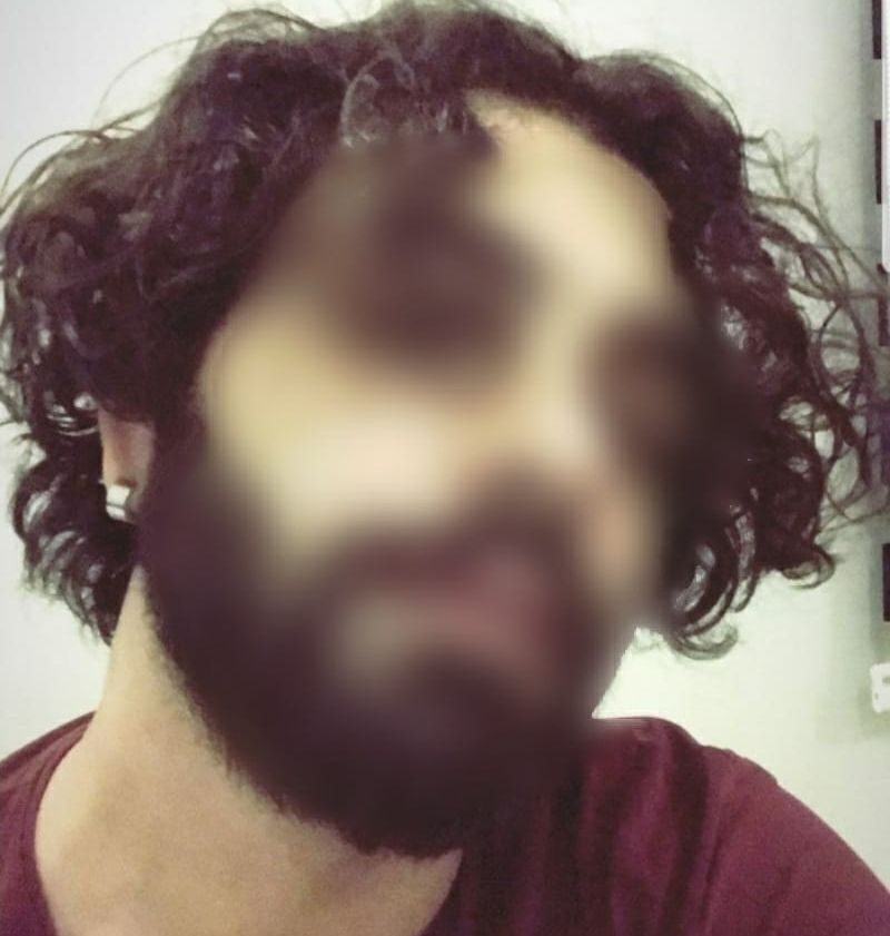 Adana'da Sercan Keskin'in 'cinsel terapi' iğrençliğini mağdur kadın ifşa etti