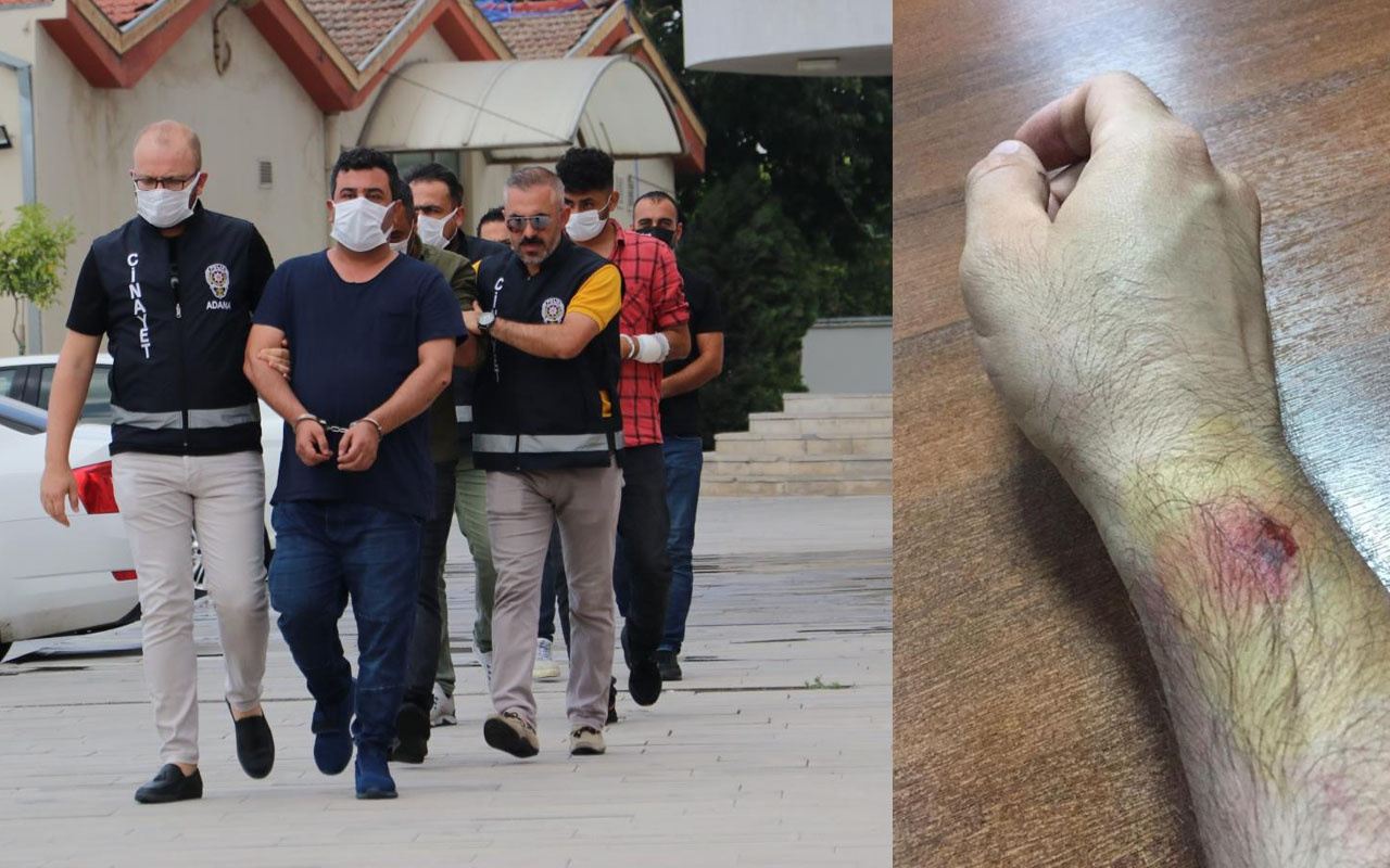 Adana'da baskında kumar parasını kaptırınca komiserin kolunu ısırdı