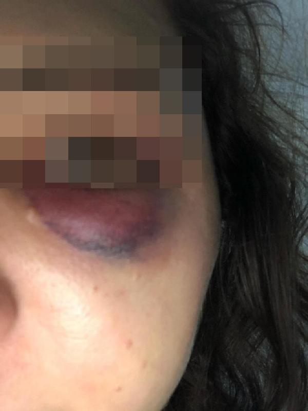 Bağcılar�da sevgilisinin evine bomba attığı kadın Olaydan önce birçok