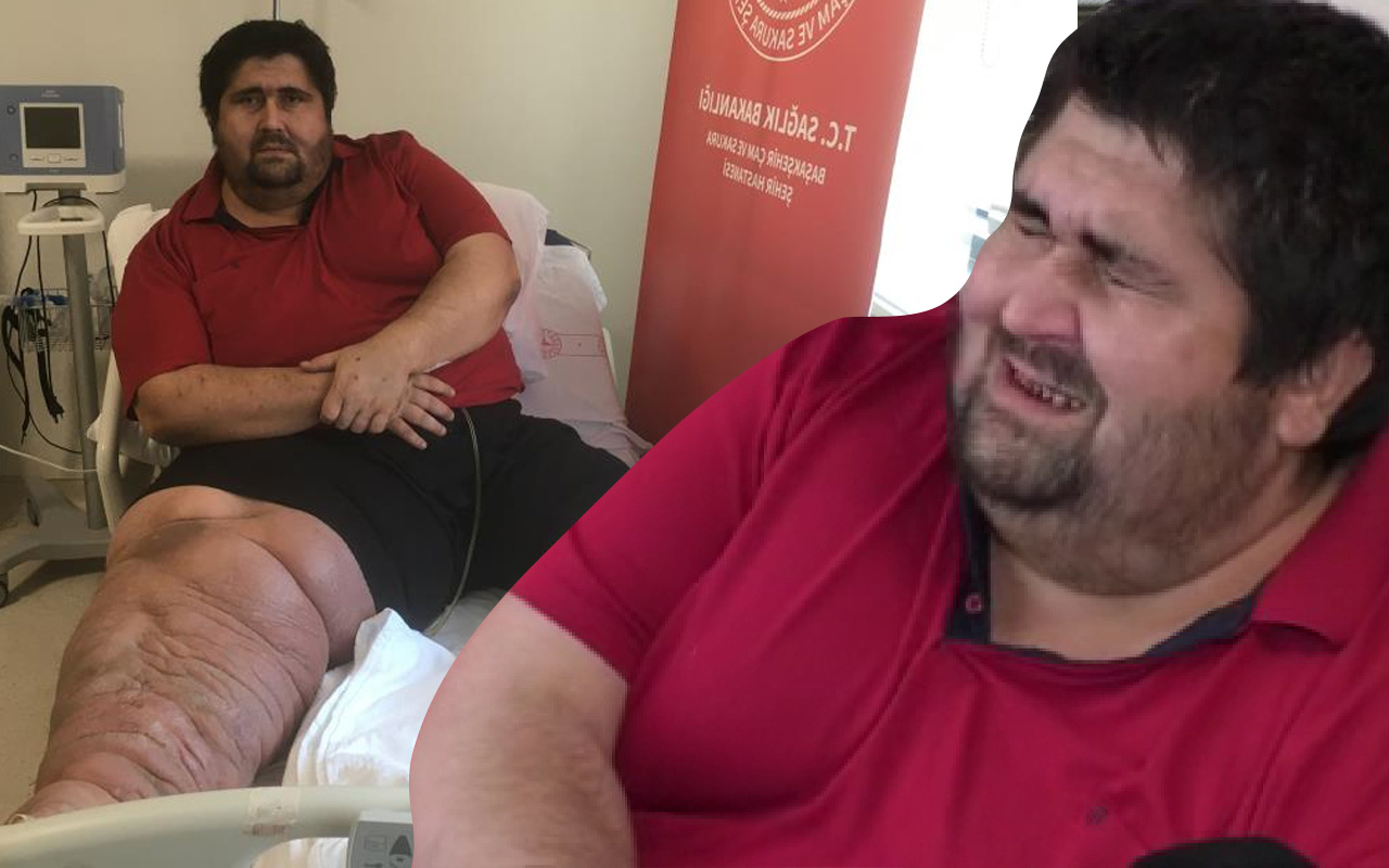 8 yıl önce öğrendi 300 kiloya çıktı! Gözyaşlarıyla anlattı: En büyük hayali...