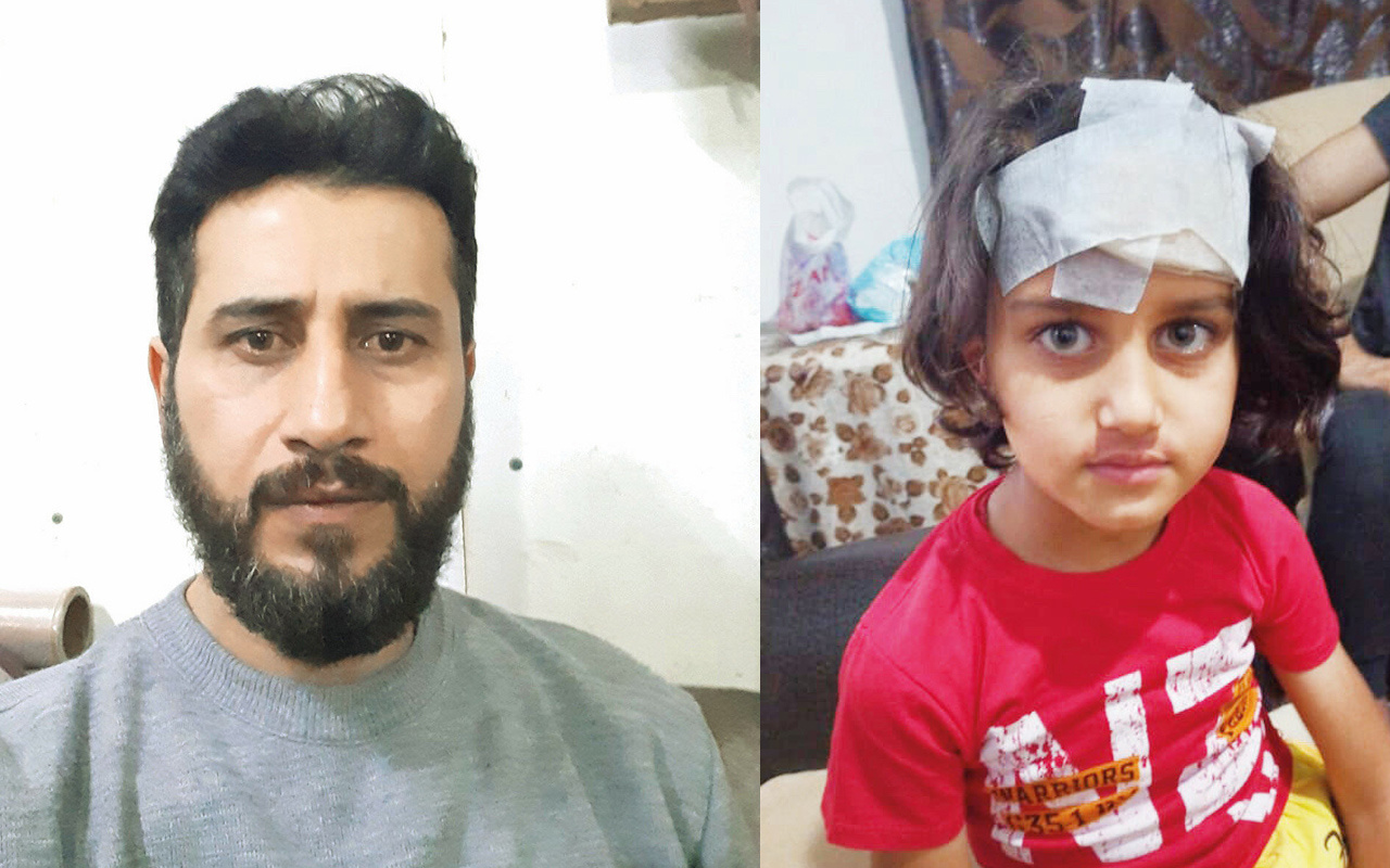 Altındağ olayında yaralanan Suriyeli çocuğun babası konuştu: Hiçbirini tanımıyorum