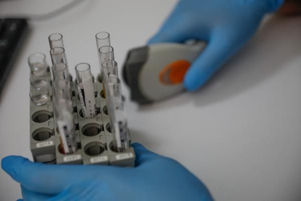 İstanbul'daki laboratuvarlarda 6 Eylül hazırlığı! Zorunlu PCR testi dönemi başlıyor
