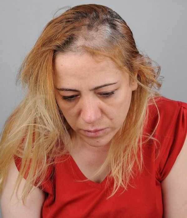 Gaziantep'te küfürler savurup kabusu yaşattı! Saçları avuç dolusu yolundu: Psikolojim çok bozuldu