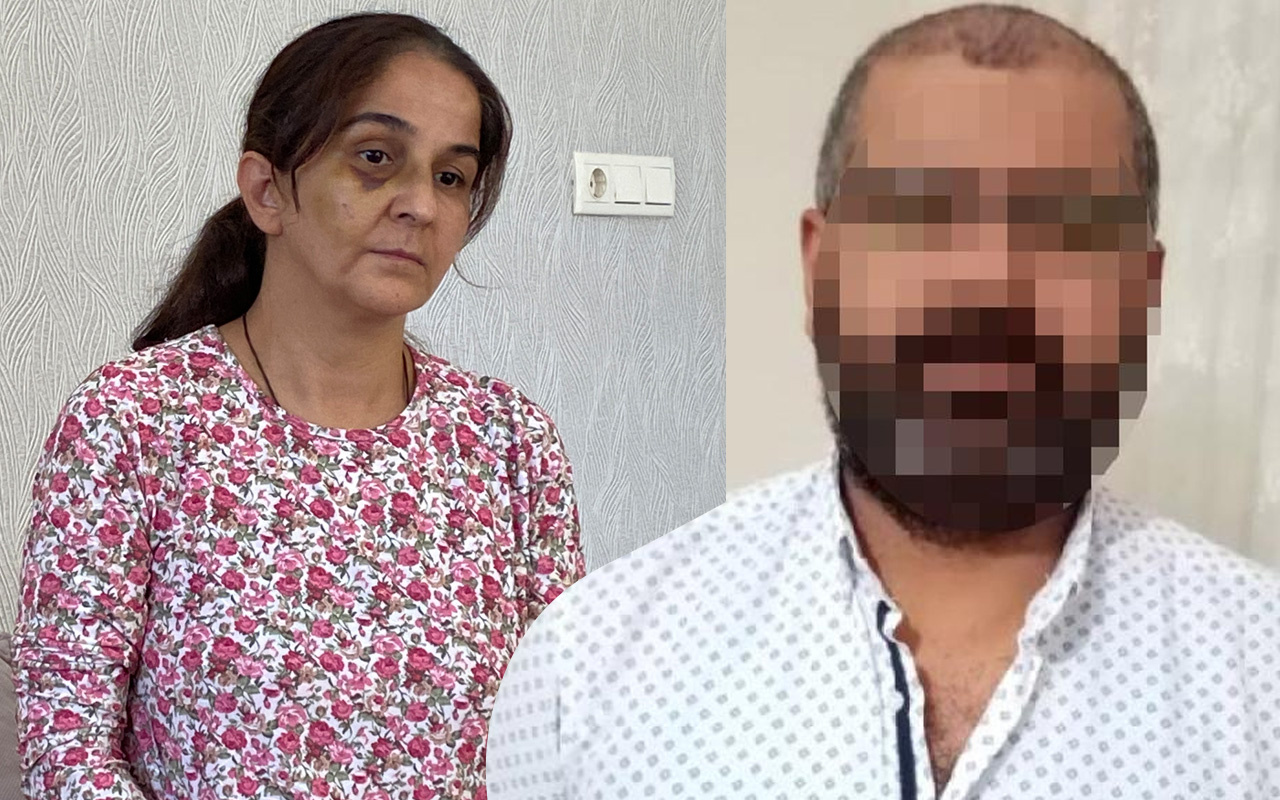 Eskişehir'de eşi kabusu yaşattı! Ayaklarıyla ezdi kafasını duvarlara vurdu: Tuvalete gidip...