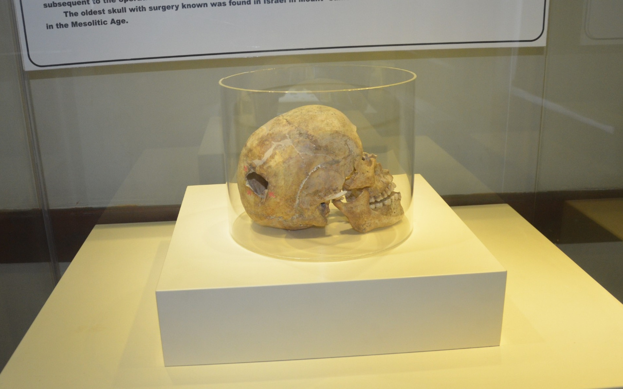 Samsun'da 3 bin yıllık kafatası bulundu! Üzerindeki izi gören şaştı kaldı