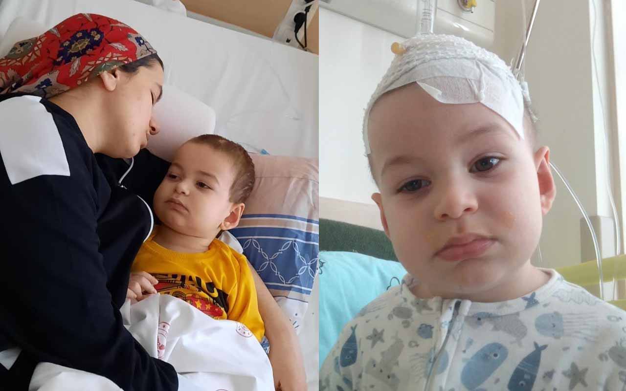 Baş dönmesiyle hastaneye götürdüler 3 yaşındaki çocuğun başında tümör çıktı