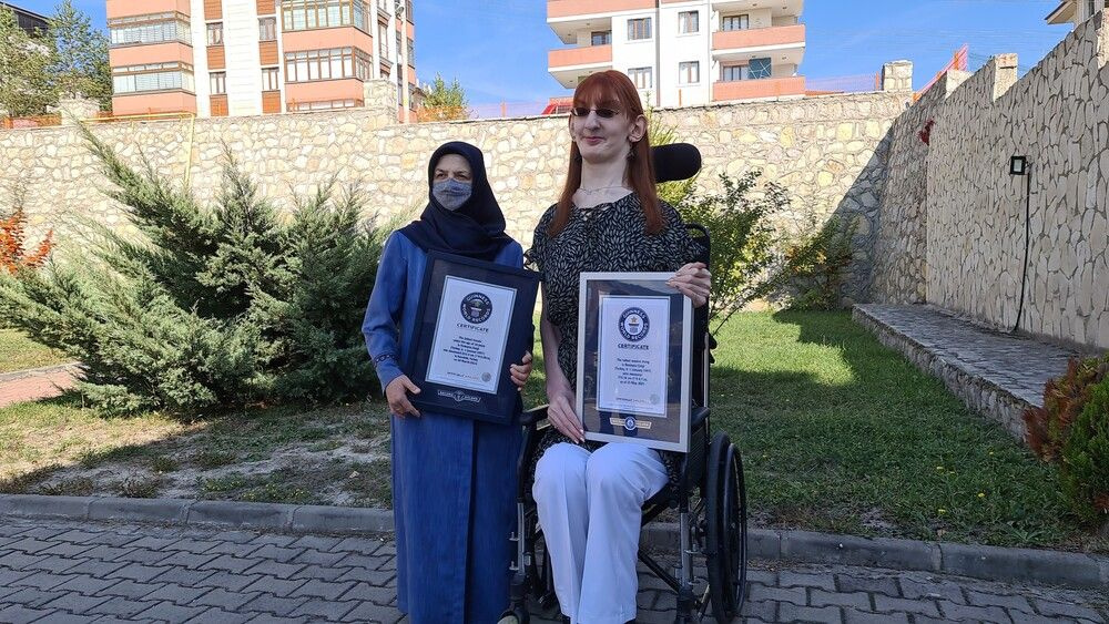 Dünyanın en uzun kadını Karabüklü! 'Gizlemek zorunda kaldım' deyip Rümeysa Gelgi anlattı