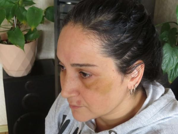 Üsküdar'da boşanma davası açtığı kocası kabusu yaşattı! Darbetti, otomobilini yaktı, tehdit etti