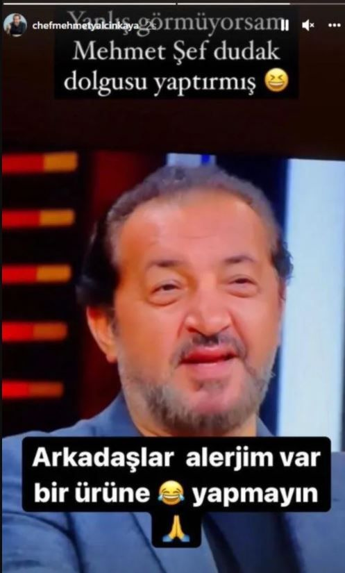 TV8 MasterChef Mehmet Yalçınkaya dudak dolgusu mu yaptırdı olay paylaşım