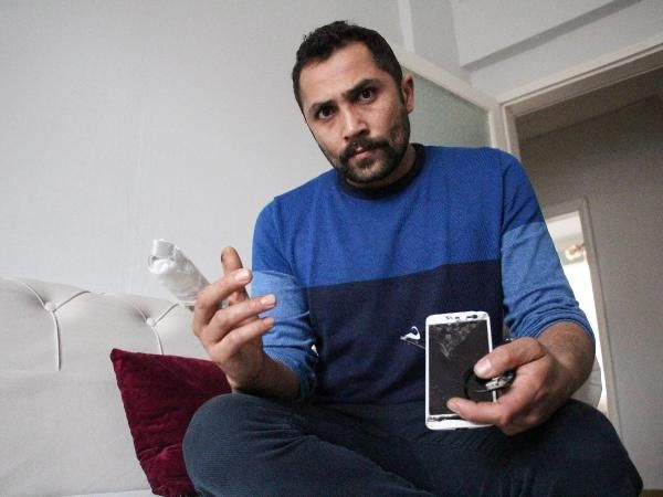 Olay yeri Erzurum! Bomba gibi patlayan powerbank parmağını kopardı