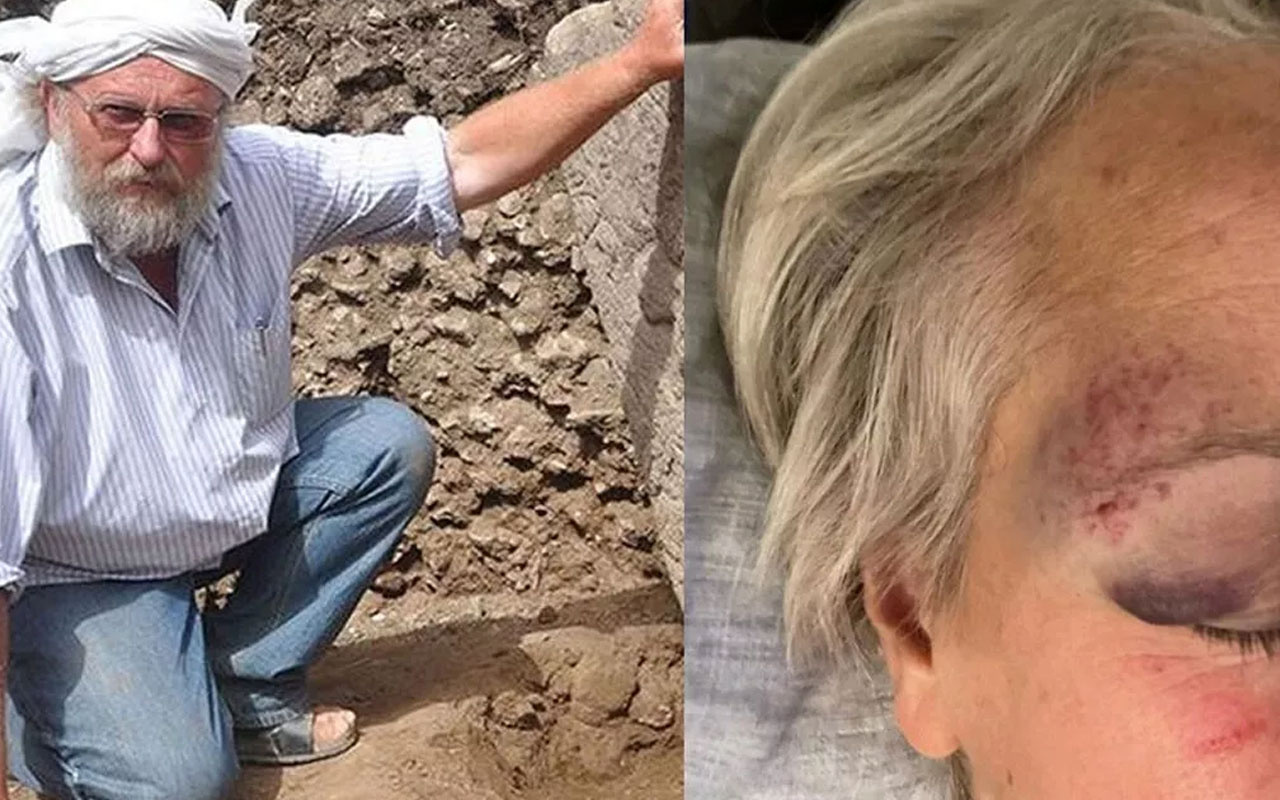 Göbeklitepe'de kazı başkanlığı yapan Alman arkeoloğun eşinden darp iddiası