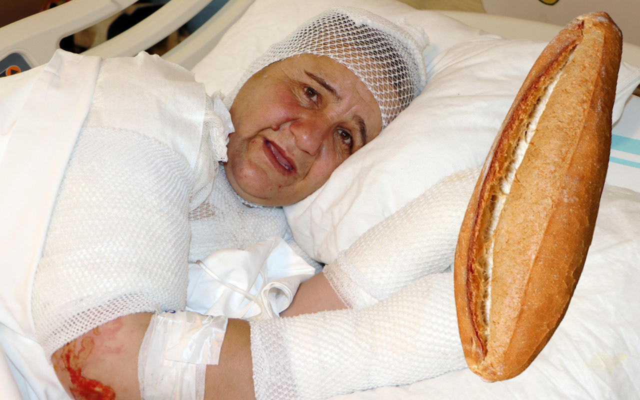 Muş'ta ekmek yaparken bu hale geldi: Dayanılmaz acılar çekiyorum, başıma ilk defa böyle bir kaza geldi