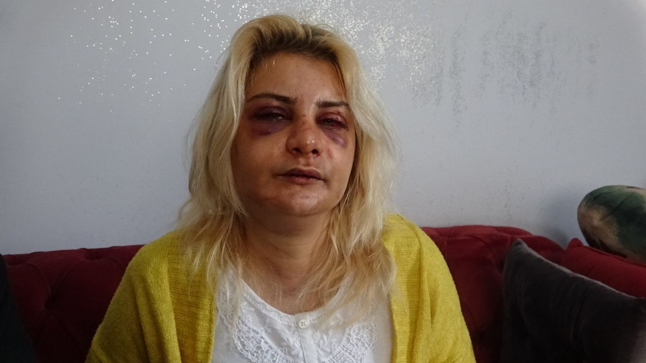 Evini basıp genç kadını 2 saat dövdüler! Yorgana sarıp kaçıracaklarda çığlıklarına polis yetişti