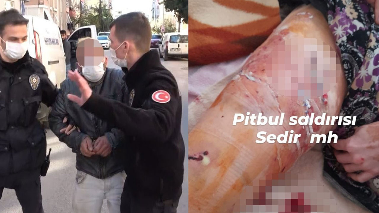 Antalya'da pitbull dehşeti! Bacağı kesilebilir