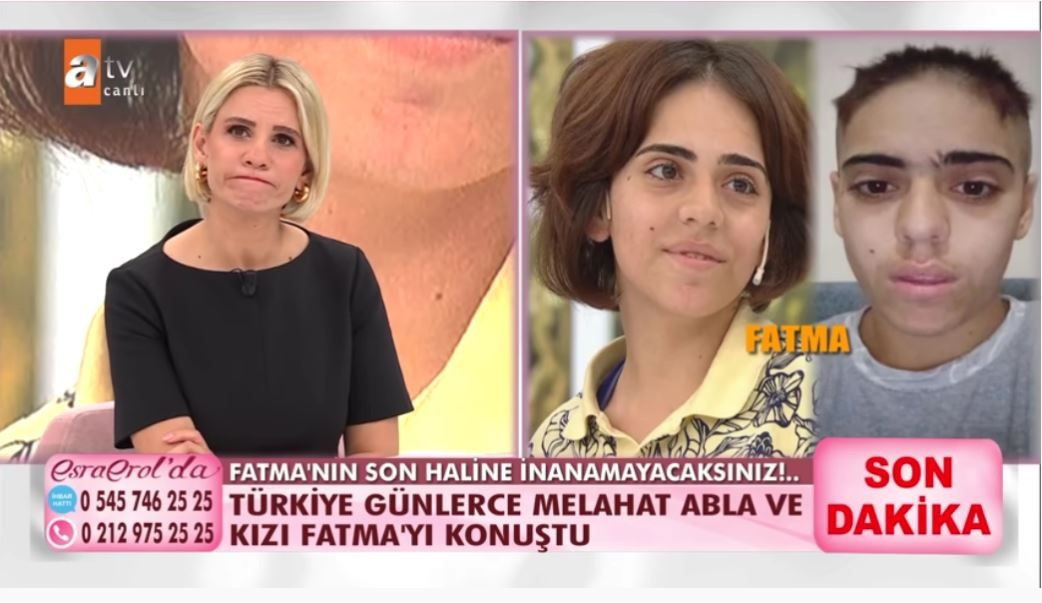 ATV Esra Erol'daki zihinsel engelli Fatma sevgilisi Ahmet, kuması ve onun sevgilisiyle yaşıyor! Rezalet!