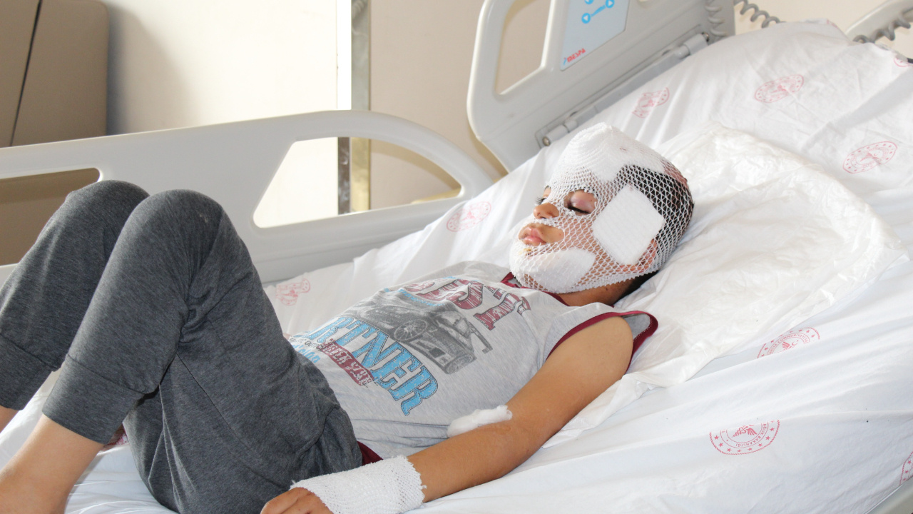 Mardin'de sokakta oynarken dehşeti yaşadı: Önce yüzümü, kafamı sonra da ellerimi ısırdı