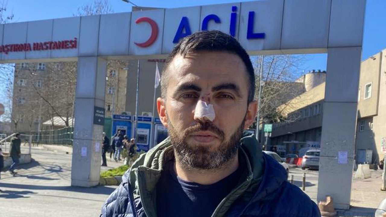 Ümraniye'de sağlık çalışanına saldırı kafa atıp burnunu kırdı