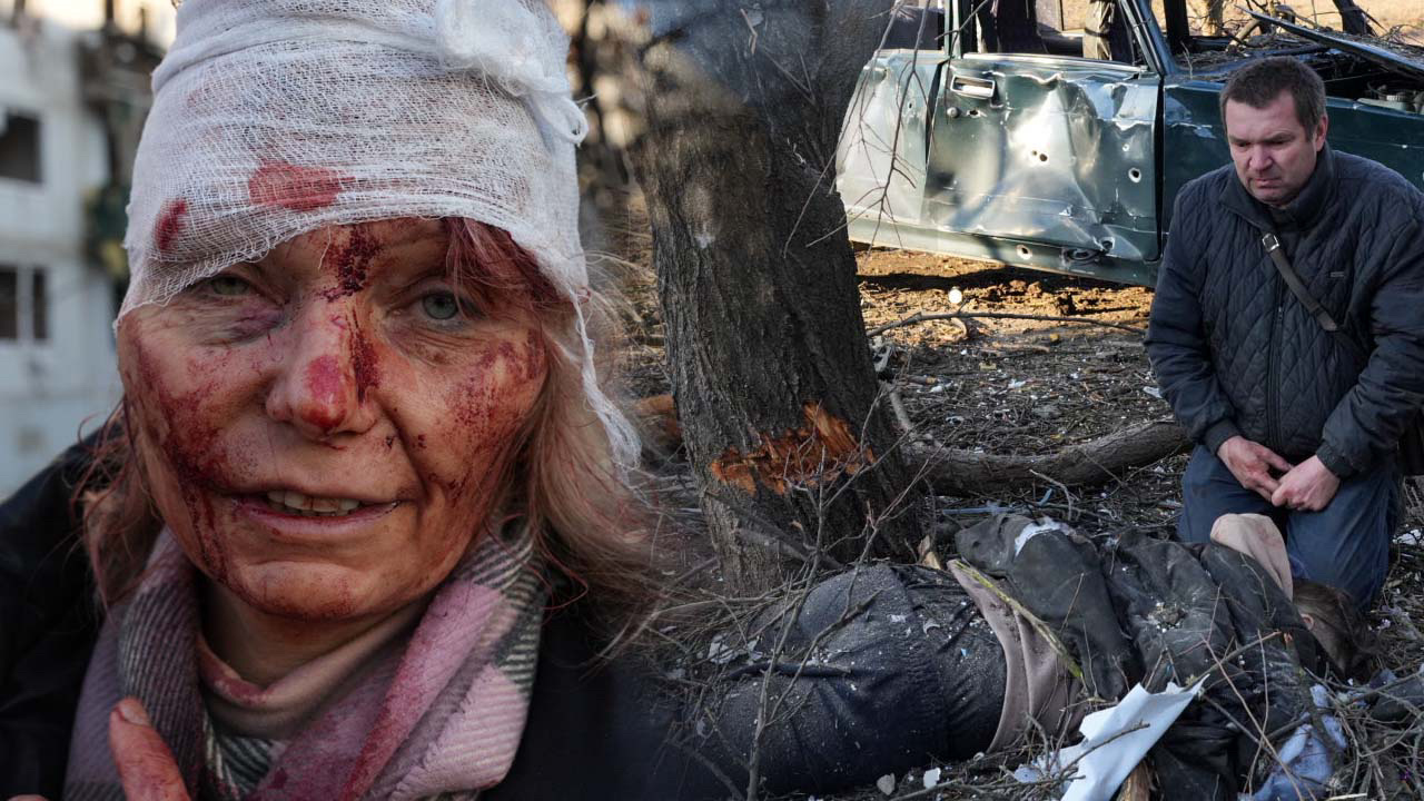 Ukrayna'dan korkunç görüntüler! Ölü ve yaralılar gelmeye başladı