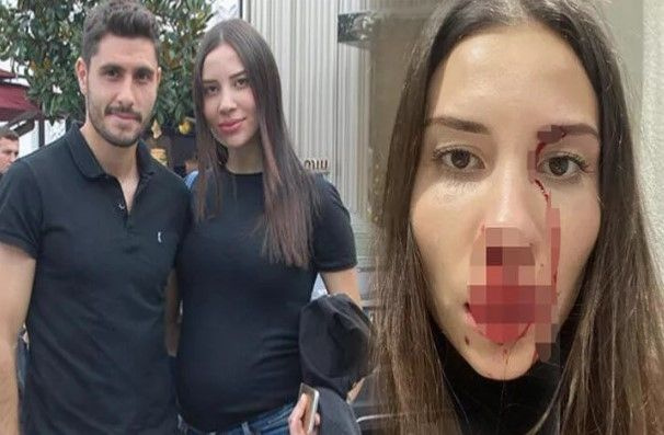 Futbolcu Özer Hurmacı ile eşi Mihriban Hurmacı'ya 1,5 yıla kadar hapis talebi