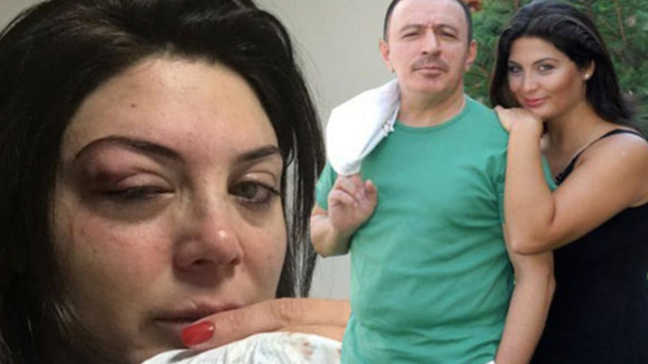 Mustafa Topaloğlu'nun eşinden kötü haber geldi! Duyanlar hastaneye koştu!