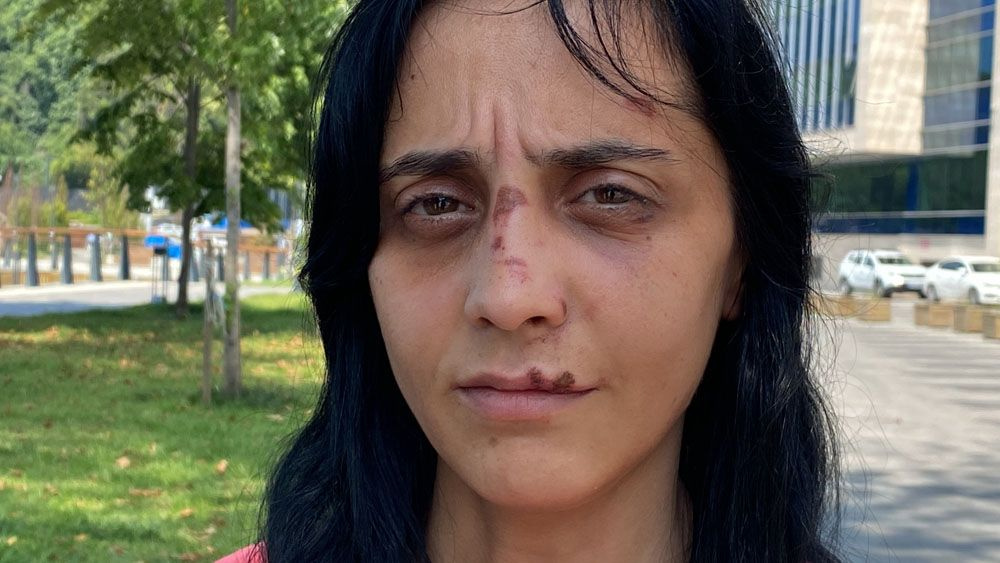 Zonguldak'ta genç kadın iş çıkışı dehşeti yaşadı! Neye uğradığını şaşırdı korkunç!