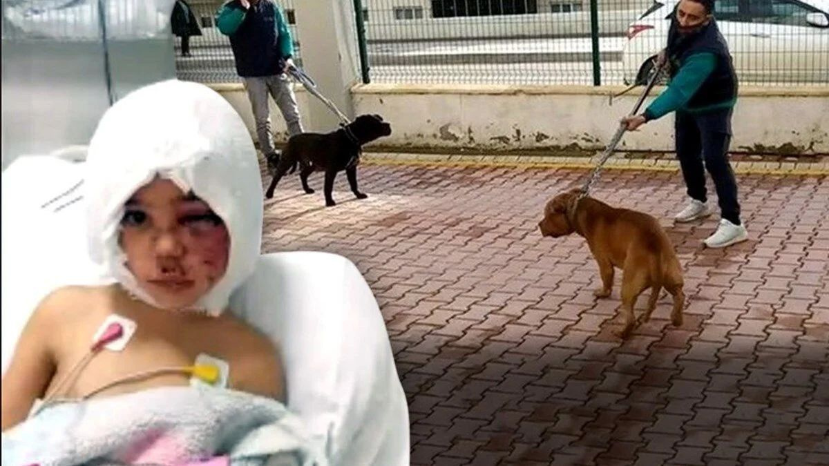 Pitbull saldırısında parçalanan Asiye'ye anne işkencesi! Şok fotoğraflar ortaya çıktı böyle bağlamış!