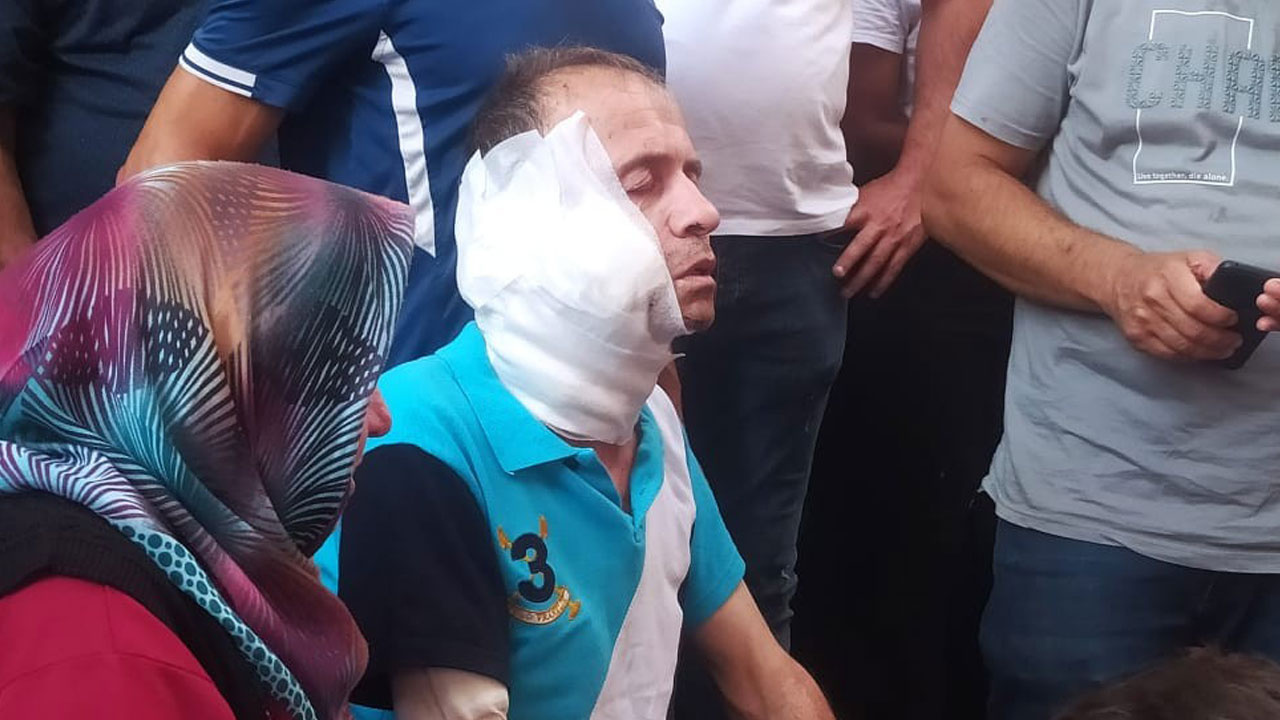 Zonguldak'ta komşu kadının boğazını baltayla kesip öldürdü eşini ağır yaraladı