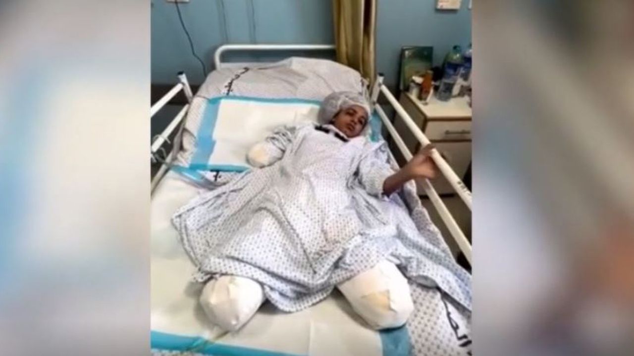 Saldırıda iki bacağı ve kolunu kaybeden 11 yaşındaki kız, Cumhurbaşkanı Erdoğan'a seslendi