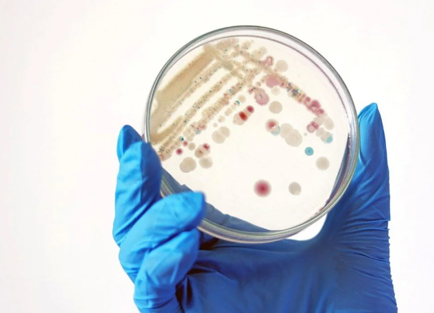 İnsan eti yiyen bakteri kabusu! ABD'de vakalar katlandı 2 yolla bulaşabiliyor