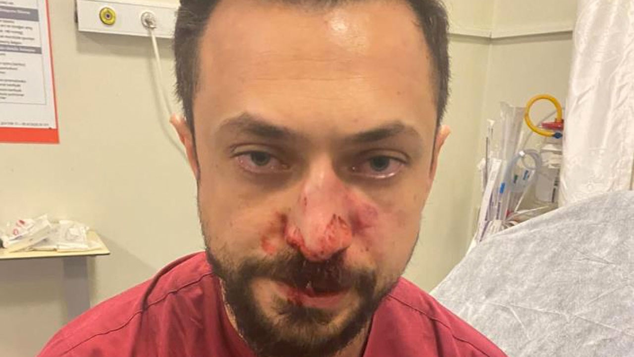 Acil Servis'te 'önce benim hastama bak' kavgası! Hasta yakını doktorun burnunu kırdı
