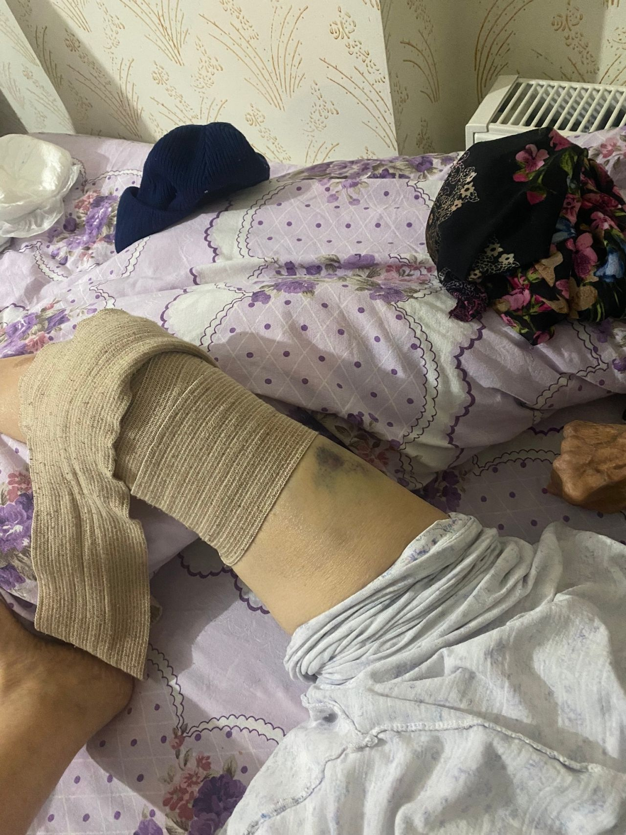 Ankara’da bakıcı dehşeti! 91 yaşındaki kadına resmen işkence yaptılar ölüm kalım savaşı veriyor