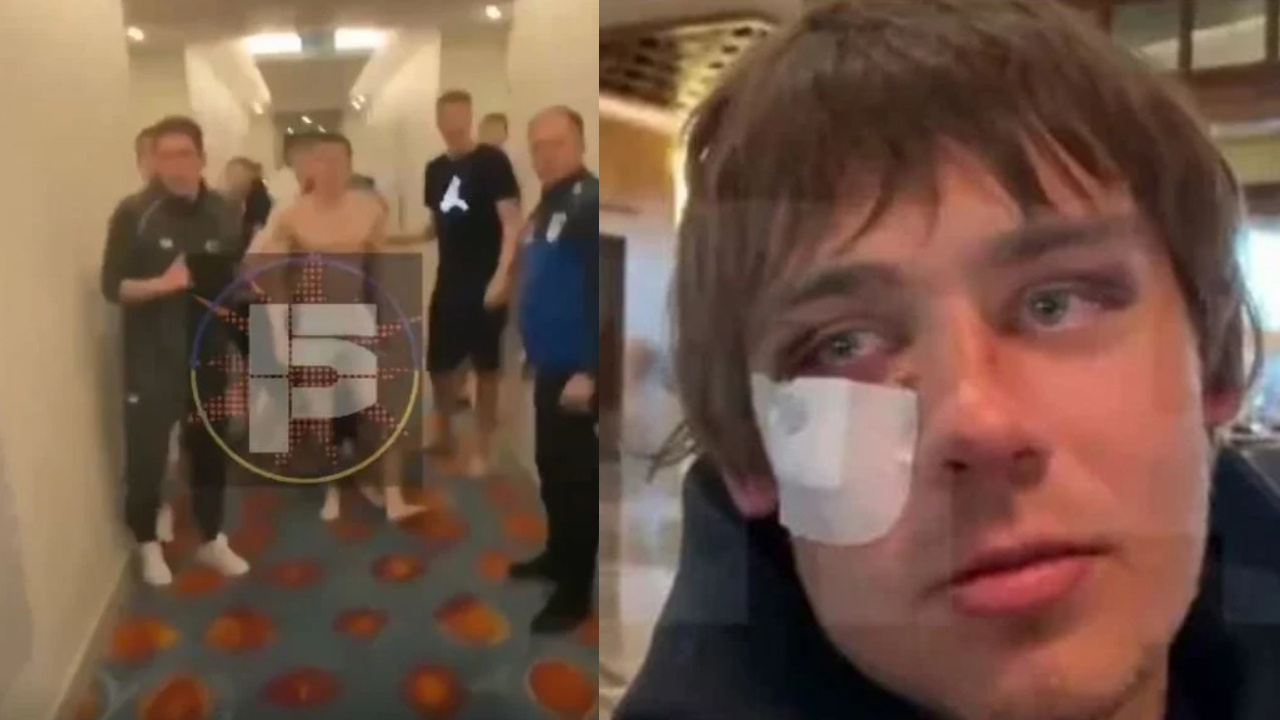 Antalya'da Rus ve Ukraynalı futbolcular tekme tokat kavga etti: Kemirleri kırıldı!