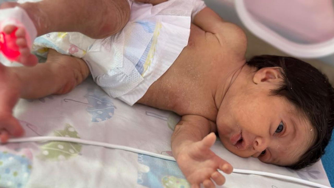 Hataylı Depremzede Asel bebek, Adana’da hayata tutundu