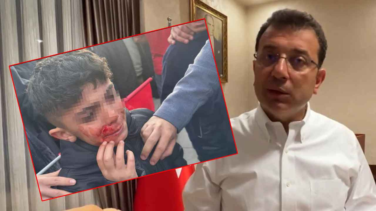 İmamoğlu fotoğrafı gösterip isyan etti: "Şu çocuğu orada polis koruyamadı"