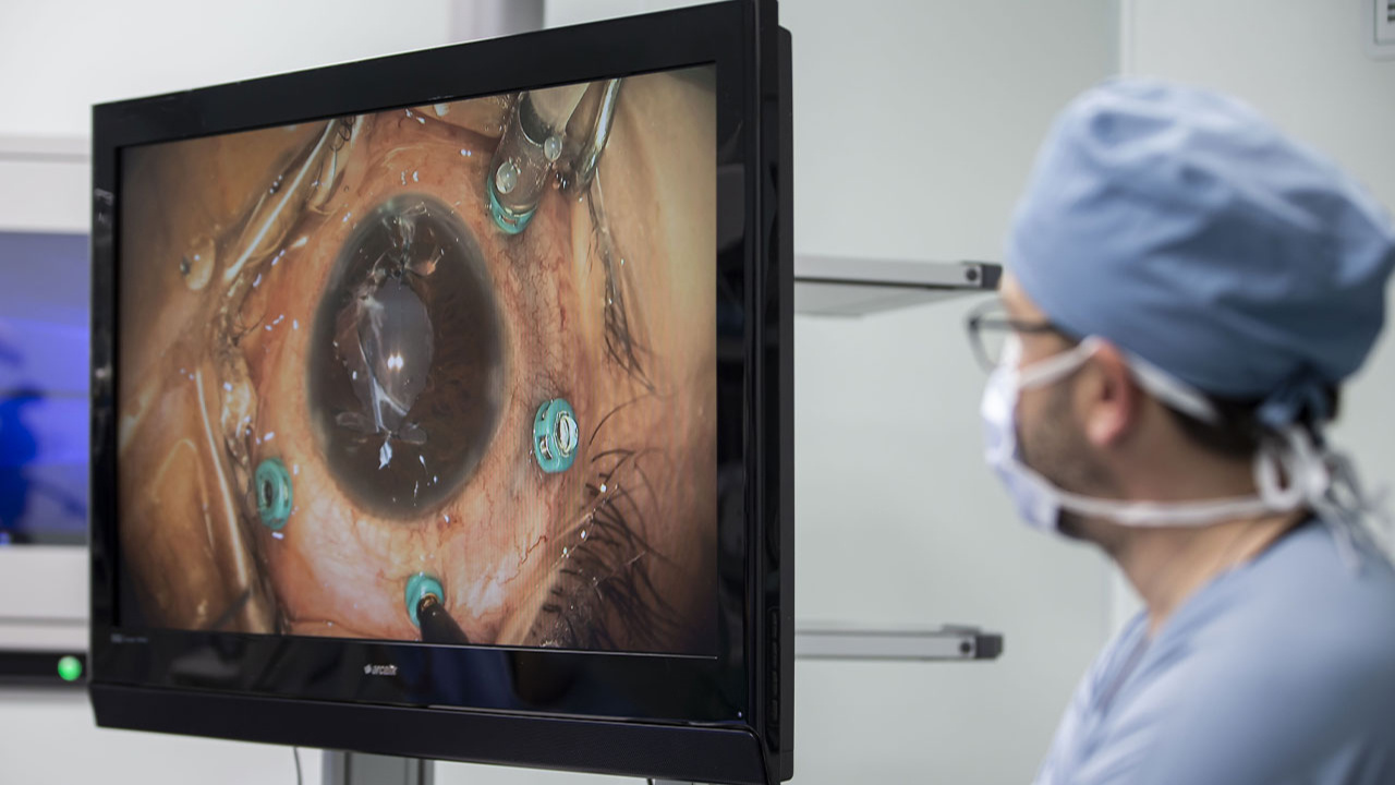 Göz hekimleri canlı yayında 70 göz ameliyatına imza atacak