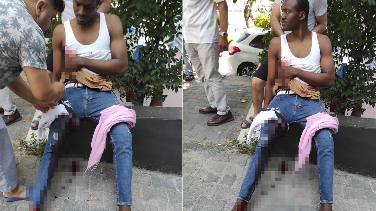 İstanbul’da 'yanlış zil' dehşeti! Önce bıçaklandı, sonra vuruldu