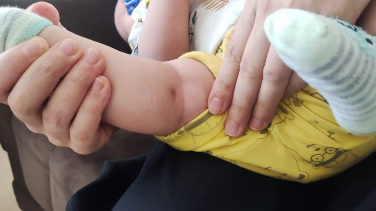 İki aylık bebeğin bacağından enjektör iğnesi çıktı! Doğduğu günden beri ağlıyordu
