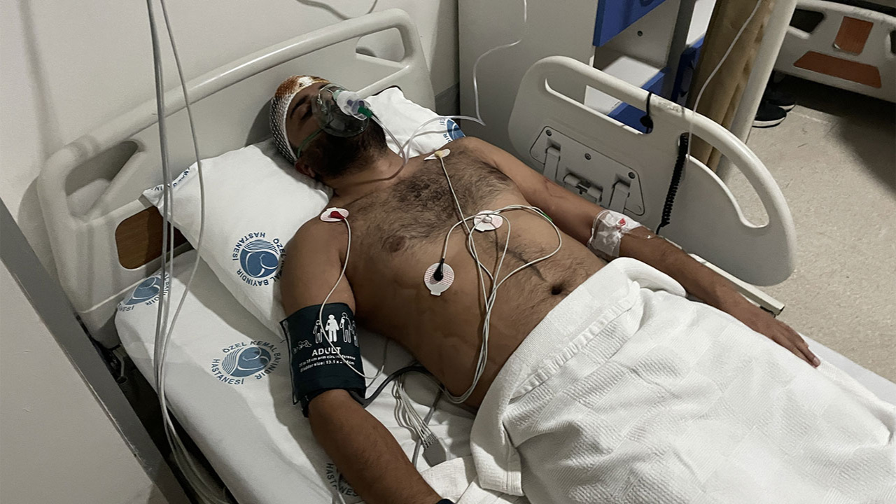 Gaziantep'te hasta yakınlarının kemer ve demir çubuklarla dövdüğü doktor yoğun bakıma alındı