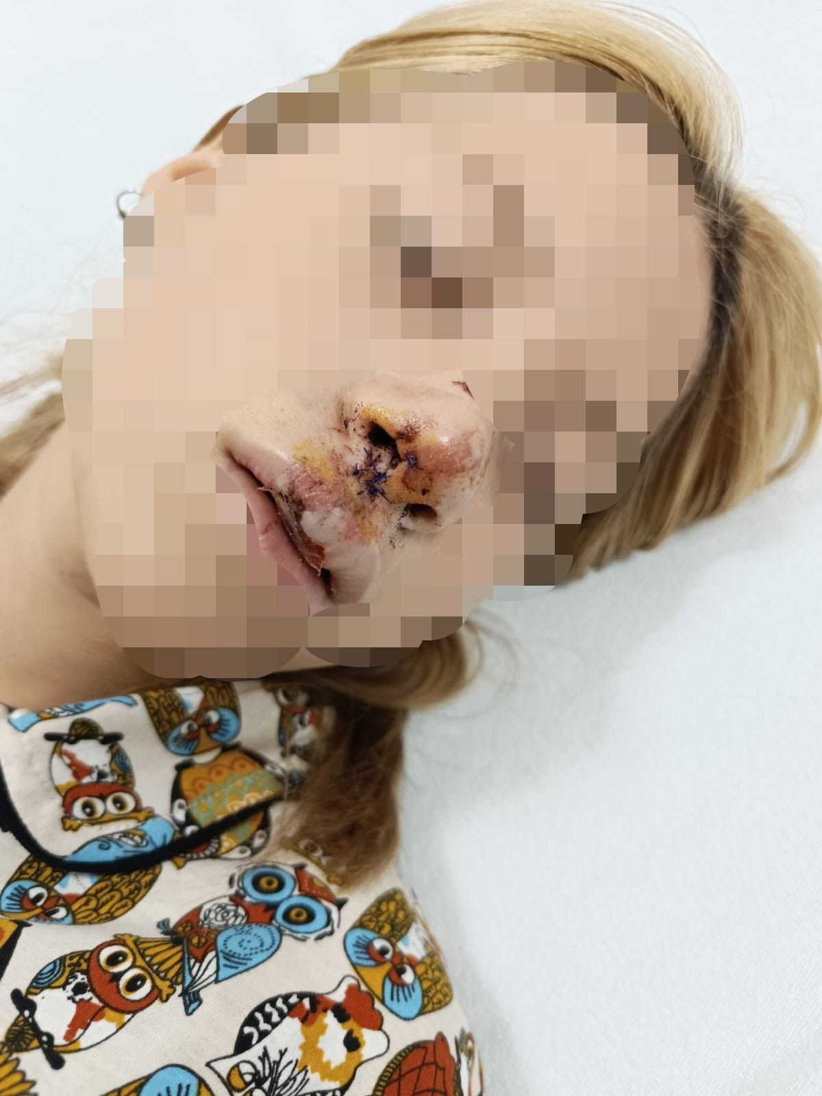 İstanbu'da dehşet! Genç kızın dişlerini kaldırım taşı ile kırdılar, yanındaki erkeğin kulağını kestiler