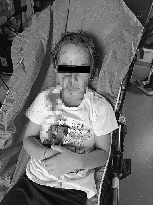 İstanbul'da başıboş köpek dehşeti! 6 yaşındaki kızın yüzünü parçaladı! Küçük kız kuduz mu oldu?