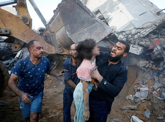 Kafası kopmuş çocukları anlatırken kelimeler boğazında düğümlendi! Gazze'den yürek yakan fotoğraflar...
